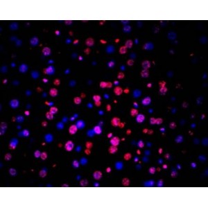 TUNEL LiFluor™ 594 Apoptosis Detection Kit (50 rxn)